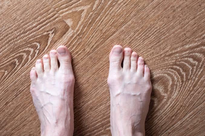 What Your Feet May Be Telling You About Your Health: Key Signs to Watch For