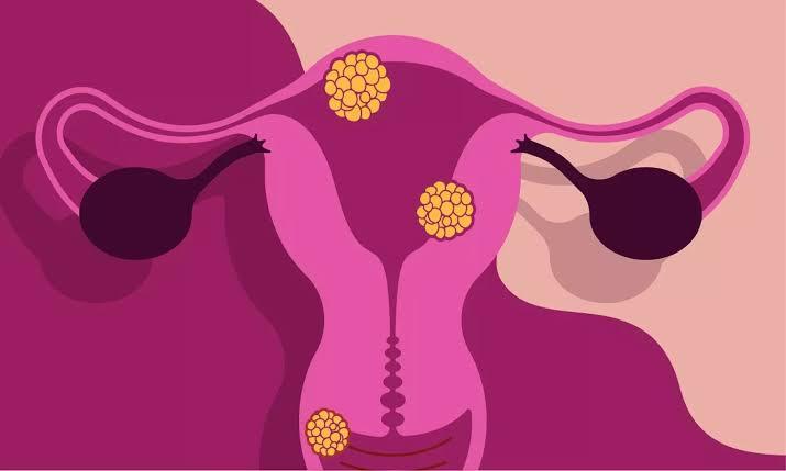 The Benefits of Probiotics for Vaginal Health and Preventing Infections