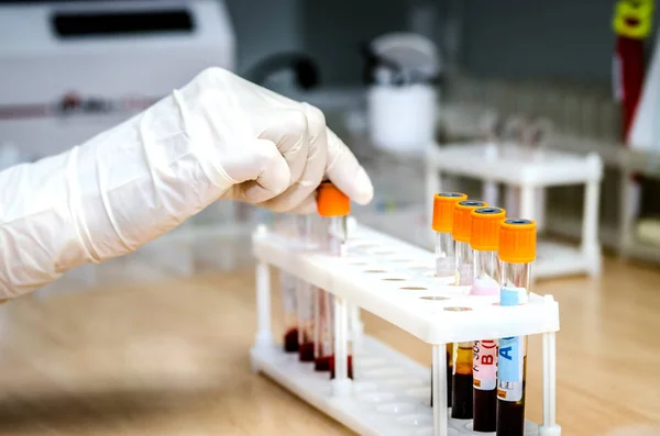 New Human Blood Group System: MAL Solves 50 Year Mystery
