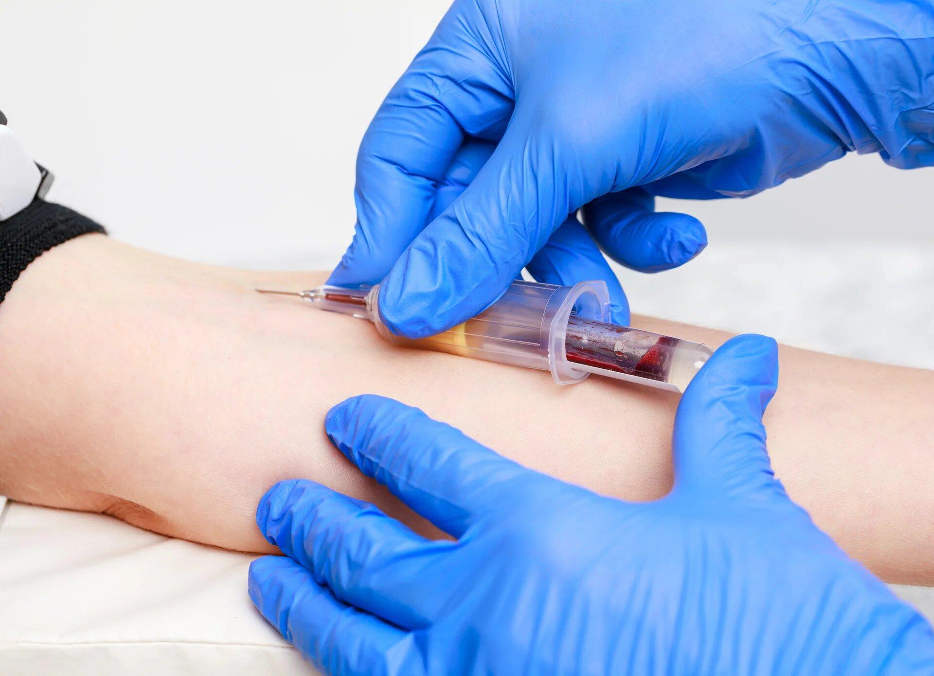 Anaemia
