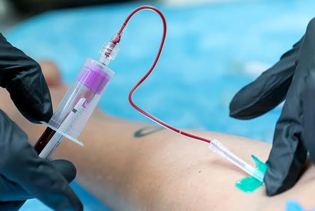 Complete Blood Count (CBC): The Silent Guardian of Your Health