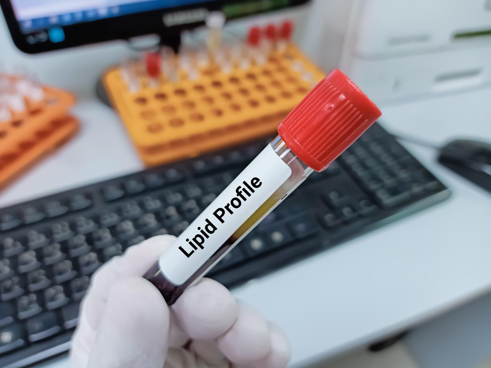 Lipid Profile: What Your Cholesterol Levels Reveal About Your Heart
