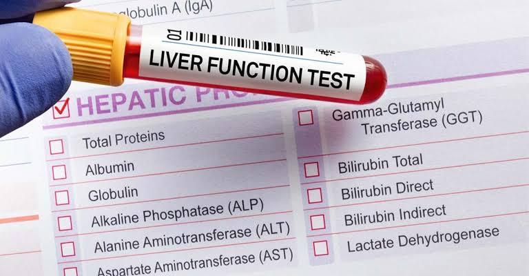 Liver Function Tests (LFTs): A Snapshot of Your Liver Health