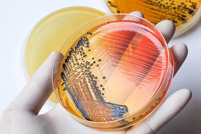 Microbiological Tests: The Key to Identifying Hidden Infections