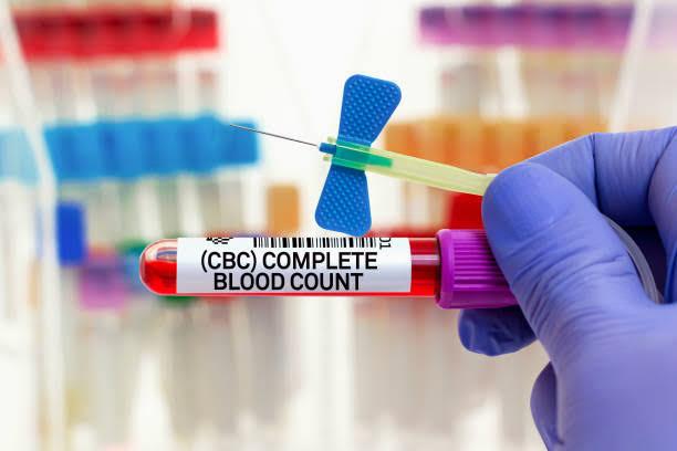 Complete Blood Count (CBC): A Deep Dive Into One of Medicine’s Most Essential Tests