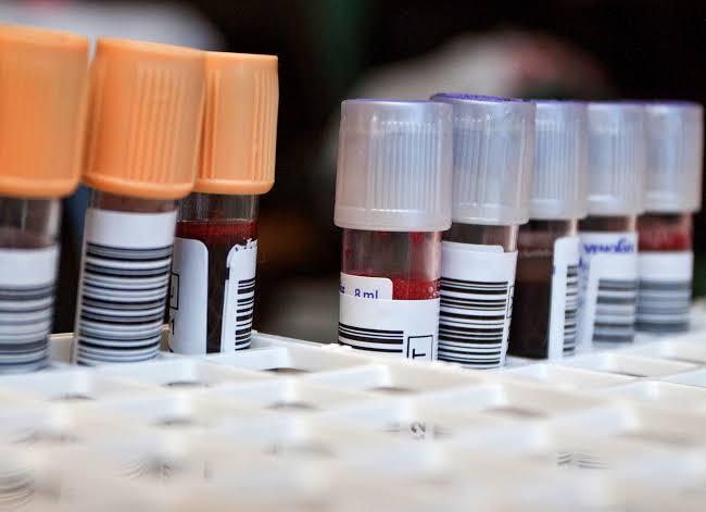 Basic Metabolic Panel (BMP): The Test That Tells You More Than You Thinking