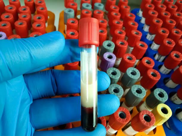 Lipid Panel (Cholesterol Test): What Your Numbers Really Mean
