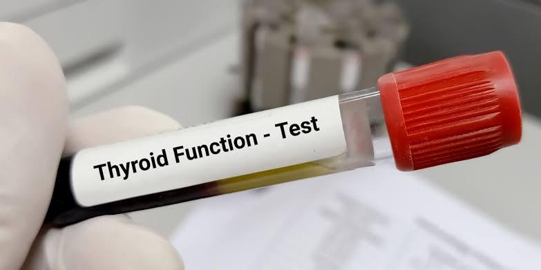 Thyroid Function Test (TFT): What Your Results Reveal About Your Health