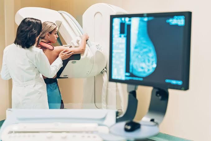 Frequently Asked Questions About Mammograms