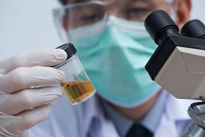 What Your Pee Says About Your Health (And Why You Should Listen)