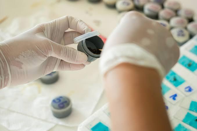 Stool Tests: What Your Gut Can Reveal About Your Health