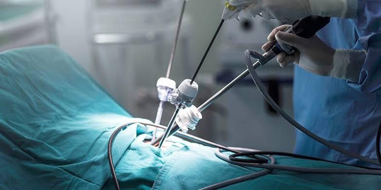Appendectomy: Everything You Need to Know Before, During, and After Surgery
