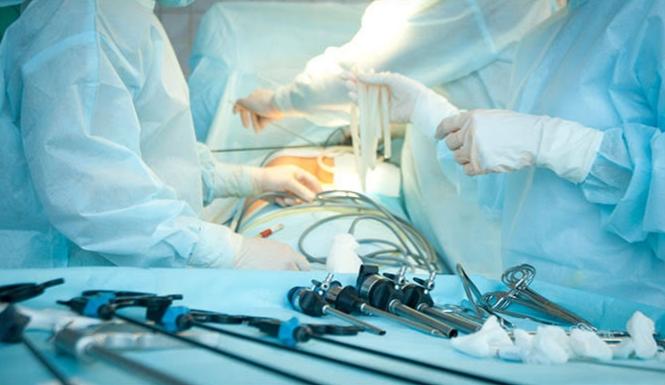 Gallbladder Removal (Cholecystectomy): Treating Gallstones and Gallbladder Disease