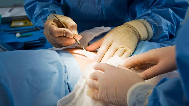 Mastectomy: What to Expect Before, During, and After Surgery