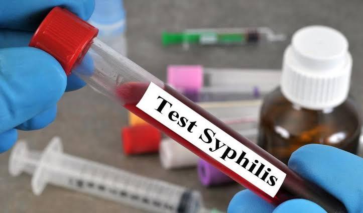 Rising Cases of Syphilis: Understanding the Risks, Symptoms, and Effective Treatment