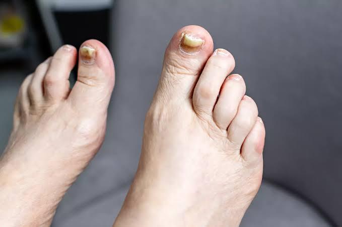 Are Your Feet Trying to Warn You? 7 Silent Signs of Serious Health Issues
