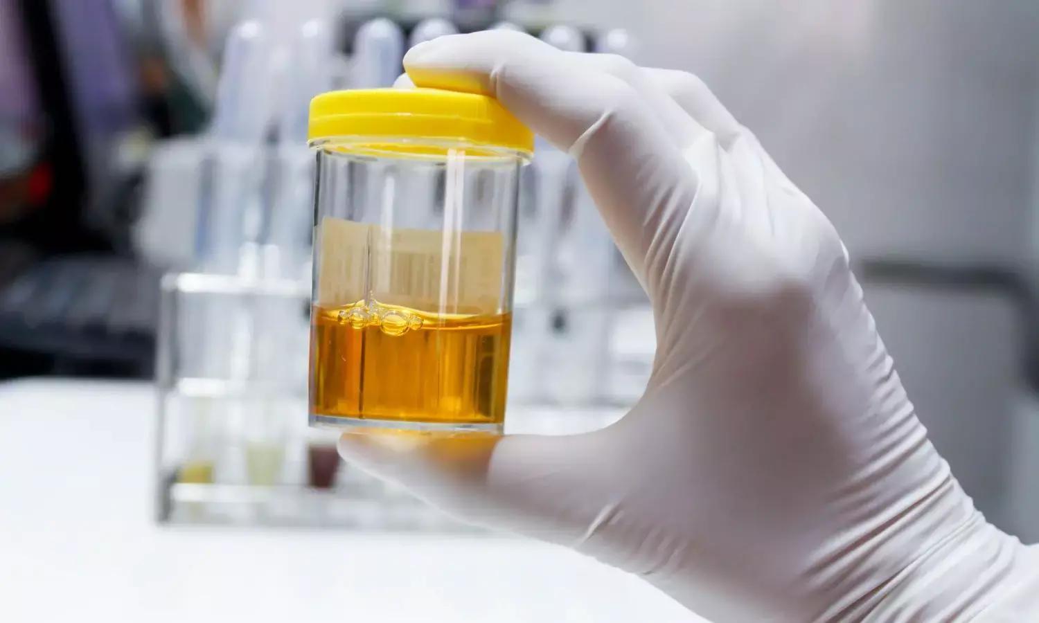 Is Urine Really Sterile? The Science Behind This Common Health Myth