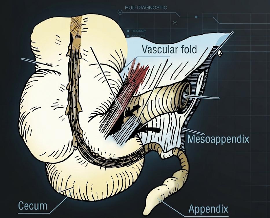 Appendix Pain Location How to Know If It Is Appendicitis